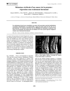 Métastase cérébrale d`un cancer de la prostate : régression sous