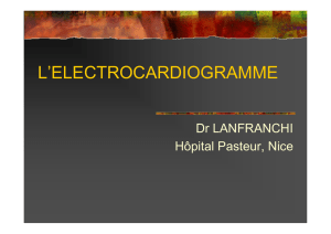 l`electrocardiogramme
