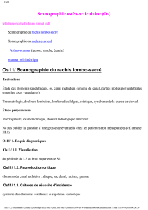 Scanographie ostéo-articulaire (Os) Os11/ Scanographie du rachis