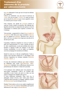 Traitement d`un adénome de la prostate par adénomectomie