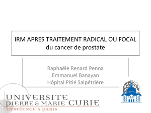 IRM APRES TRAITEMENT RADICAL OU FOCAL du cancer de