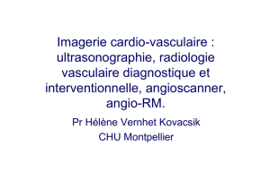 Imagerie cardio-vasculaire : ultrasonographie, radiologie vasculaire