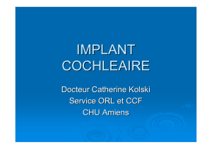Implants cochléaires