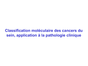 Classification moléculaire des cancers du sein
