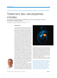 Traitement des valvulopathies mitrales