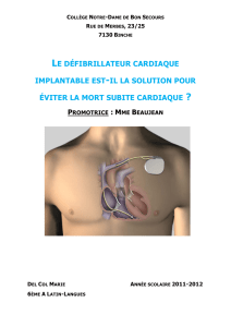 le défibrillateur cardiaque implantable est-il la solution pour
