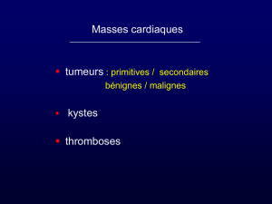 Tumeurs - thrombose