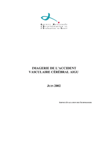 Imagerie de l`accident vasculaire cérébral aigu