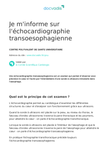 Je m`informe sur l`échocardiographie transoesophagienne