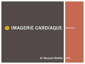 Imagerie cardiaque