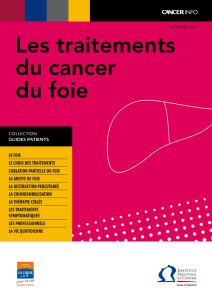 Les traitements du cancer du foie