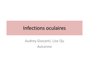 Infections oculaires