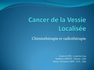 CARNOT-CT et RT cancer de vessie localise AC