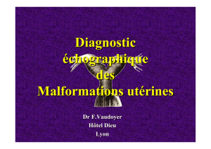 Diagnostic échographique des Malformations utérines