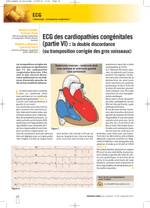 ECG des cardiopathies congénitales