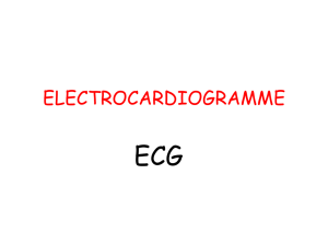 ELECTROCARDIOGRAMME
