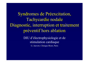 Syndromes de Préexcitation, Tachycardie nodale Diagnostic