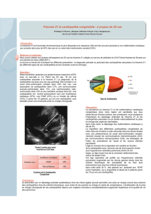Trisomie Trisomie 21 et cardiopathie congénitale et