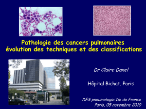 Aucun titre de diapositive - Accueil - DES de Pneumologie