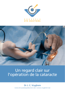 Un regard clair sur l`opération de la cataracte