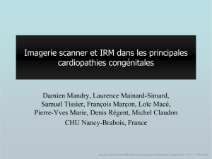 Imagerie scanner et IRM dans les principales cardiopathies