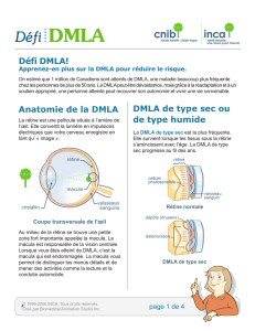 Anatomie de la DMLA DMLA de type sec ou de type humide