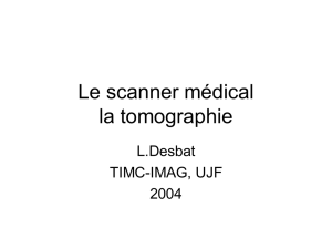 La tomographie