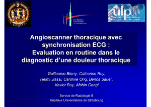 Angioscanner thoracique avec synchronisation ECG : Evaluation en