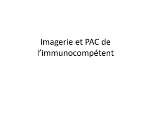 Imagerie et PAC de l`immunocompétent