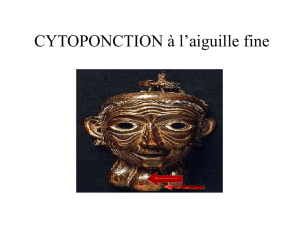 Cytoponction thyroïdienne