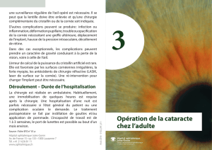 Opération de la cataracte chez l`adulte