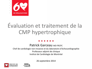 Évaluation et traitement de la CMP hypertrophique