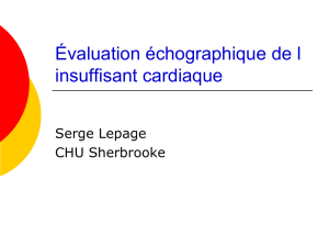 Echocardiography findings in HFNEF