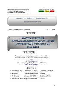 manifestations ophtalmologiques au cours de l`infection a vih/sida