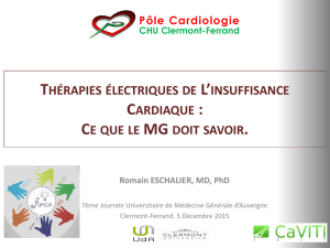 Traitement électrique de l`insuffisance cardiaque Dr R. Eschalier