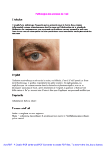 Pathologies des annexes de l`œil Chalazion Orgelet Blépharite