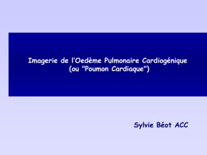Œdèmes Pulmonaires Cardiogéniques