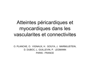 Atteintes péricardiques et myocardiques dans les vascularites et
