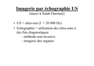 Echographie par ultrason