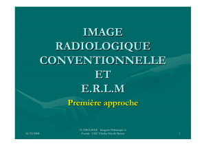 IMAGE RADIOLOGIQUE CONVENTIONNELLE ET E.R.L.M