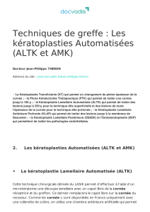 Techniques de greffe : Les kératoplasties Automatisées (ALTK et AMK)