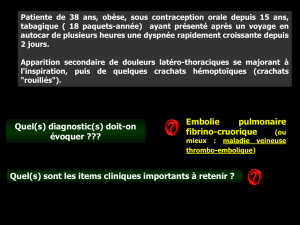 ECN 135 embolie pulmonaire