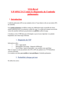 UE4-Revel-VP-SPECT-CT dans le diagnostic de l`embolie pulmonaire