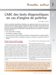 L`ABC des tests diagnostiques en cas d`angine de poitrine