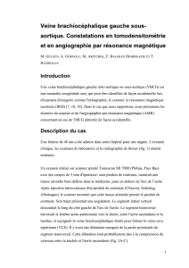 Veine brachiocéphalique gauche sousa aortique. Constatations en