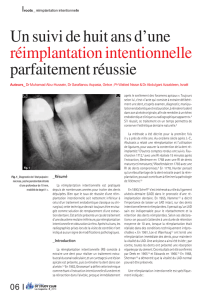 Un suivi de huit ans d`une réimplantation intentionnelle parfaitement