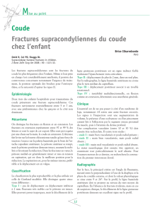 Coude Fractures supracondyliennes du coude