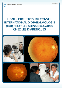 (ico) pour les soins oculaires chez les diabetiques