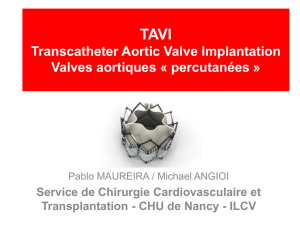 TAVI Valves aortiques « percutanées