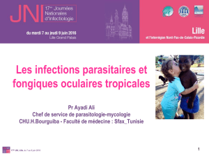 Infections ophtalmologiques fungiques et parasitaires